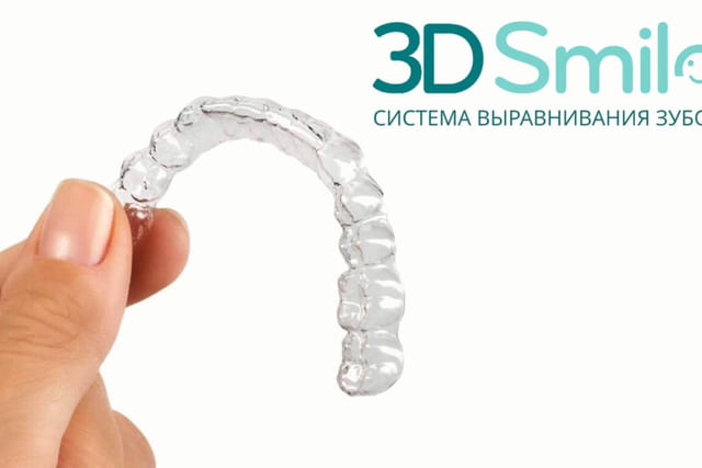 Элайнеры: выравнивание прозрачными капами